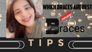 Which braces are Best🦷#viral #trending #smiledesigndental #dentalcare #dentist #dentalartistry #teet