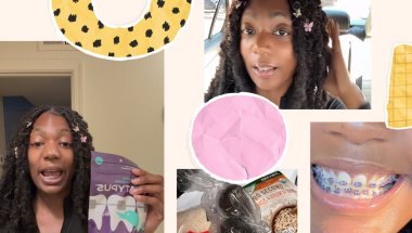 Adult braces at 32 |items you’ll need | what foods I ate| my pain level 😱😱😭🤯 | weekend vlog + plus!