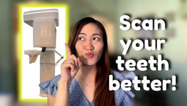 Why 3D X-Rays in Orthodontics Are a Game Changer!