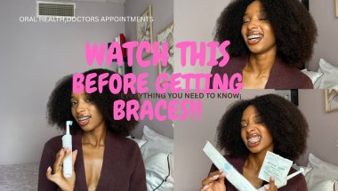Braces 101;What You Need To Know Before You Start!!