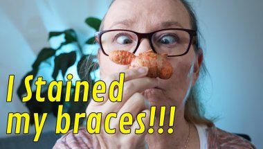 If you have braces, DON'T EAT THIS!