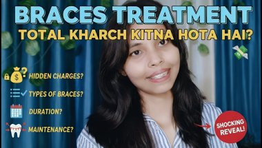 🦷🤑 Braces Cost in India 2025 || Metal braces का पूरा खर्चा कितना होता है || Hidden Charges😨