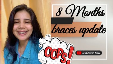 8Months braces update #viral #trending #dentalprosthesis #dentaltreatment #vlog #
