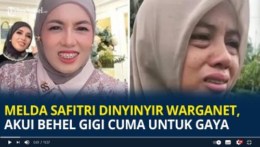 Melda Safitri Dinyinyir Warganet, Akui Behel Gigi Cuma Untuk Gaya, Dipasangh Sejak 2016