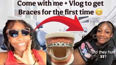 COME WITH ME TO GET MY BRACES PUT ON (THEY HURT SO BAD🤕)