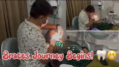 Dentist ke Paas Gayi Braces Lagwane 😁/My Braces Journey Begins! Real Experience Dental Clinic Vlog 🦷