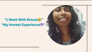 🦷 Sharing my real first week braces experience 💫#bracesjourney