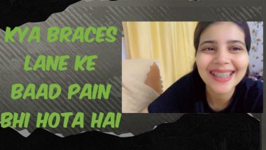 Kya braces lgane ke baad pain bhi hota hai🦷#viral #dentalprosthesis ##dentalcare #teeth