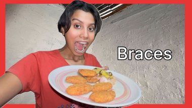 THEKUA khake braces Tut gaye ?😭 Vlog