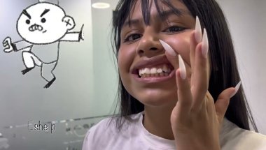Stefania Ceron se puso brackets😳(le quitaron 8 muelas😭)/FAMILIA CERON