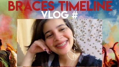 Braces timeline and pain#viral #teeth #braces #dentalprosthesis #trending #vlog