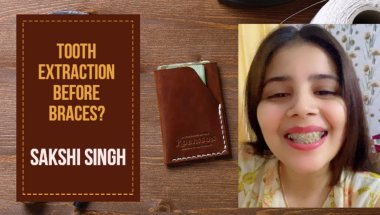 Tooth Extraction Before Braces#viral #dentist #dentalcare #trending #doctor #smiledesigndental #