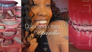 VLOG | Coloquei meu aparelho ortodôntico! 🌟| Meu novo sorriso + primeiras impressões 💋