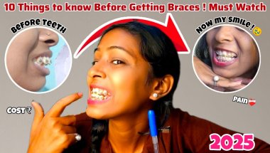 😨🦷Top 10 Tips & Tricks Before Getting Braces || Braces लगवाने से पहले ये बातें जरूर जाने Pain, Cost