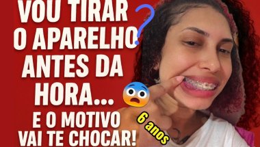 VOU TIRAR O APARELHO ORTODÔNTICO ANTES DA DA HORA… e o  motivo vai te chocar!😓
