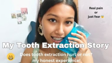 Does tooth extraction hurt or not? 🦷+ My honest experience! 😀