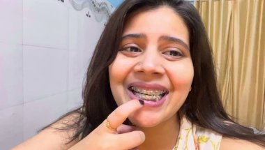 Braces cost ,Braces pain,Braces Timeline🦷🥲 Retains timeline #viral #dentist #dentalcare #trending #