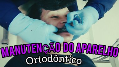 DIA DE MANUTENÇÃO DO APARELHO ORTODÔNTICO | MELHOR PREÇO DE EXTREMA MG