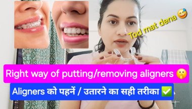 How to wear / remove aligners🤔| Aligners को पहनें/उतारने का सही तरीका ✅️ #tutorial  #aligners #smile