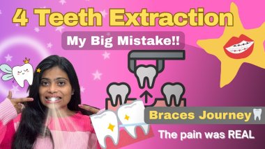 The hardest part of my Braces Journey 😢🦷|| All about Extraction and Recovery❤️‍🩹 #braces #extraction