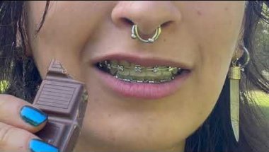 braces eating chocolate asmr