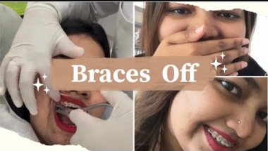 “Braces off 💫 My first mini vlog!”