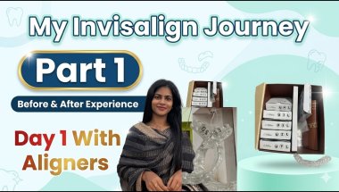 My Invisalign Journey 😬 | Honest Experience, Cost & Results | Before & After Transformation -தமிழில்