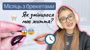 ЗʼЇЛА БРЕКЕТ😱. Ношу брекети місяць. Мій досвід