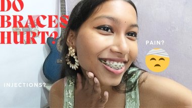 Do Braces Really Hurt? My Honest Experience 😬