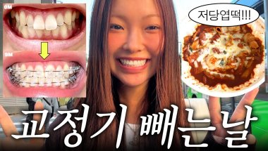 드디어 교정기 제거...🥵 교정기 빼고 엽떡으로 폭주하는 브이로그🦷💥 (+유지장치 후기^^.....)