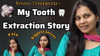 The Biggest Secret of my LIFE ||🤫My Tooth Extraction Story Braces Treatment 🦷😰