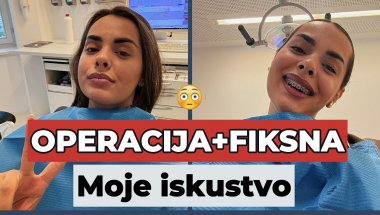 Da li bih opet prošla kroz ovo? 😳🦷 I moje iskustvo 🤍