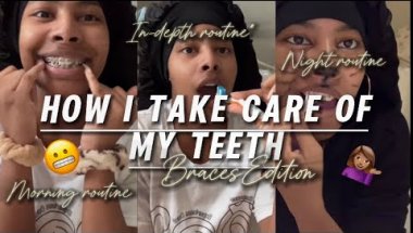 My Braces Routine: How I Take Care of My Teeth with Braces! | Brya Life