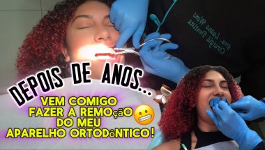 REMOVENDO MEU APARELHO ORTODÔNTICO!