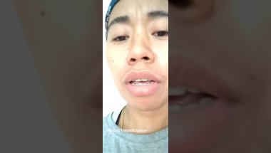 Confesion after almost month brace #teeth #tooth #realization #true