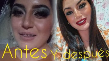 Angie antes de los brackets 💕✨️