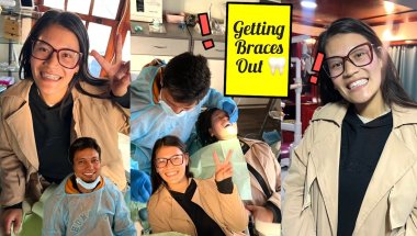 GETTING my braces remove 🦷 Agter 3.5 Year 🥹