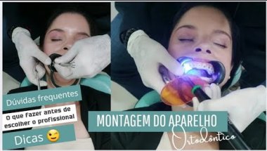 Vou usar aparelho Ortodôntico pela segunda vez