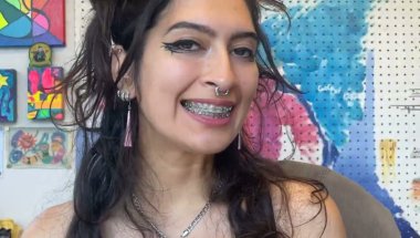 FLOSSING MY BRACES 2 years later