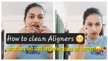 How to clean Aligners 🤐| Aligner साफ़ कर लो aise🤔 #alignersforteeth #clearaligners #braces #teeth