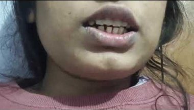 Mera tongue crip experience👌🥰!!!#braces  #dentist #bracestransformation #youtubeindia