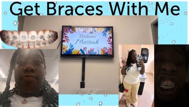 Mini Vlog & Unboxing || Get Braces with me!