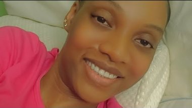 My smile progress at #tend Flatiron dental office