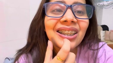 Braces lgane ke baad teeth hilte bhi hai?#viral #dentist #trending #dentalartistry #teethwhitening