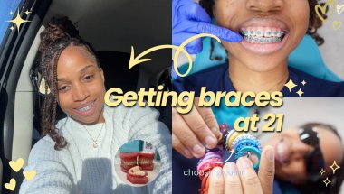 I got BRACES for the first time *vlog*