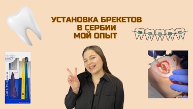 Установка брекетов | Сербия | Логопед