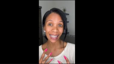 19 Months With Adult Braces… The Finish Line Is Finally in Sight 😭🦷✨ | Honest Update