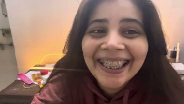 9 Months 7 days braces update #viral #dentist #trending #teethwhitening #teeth #teethwhiteningproduc