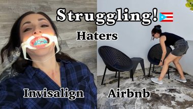 Haters Made Me Fix My Teeth + Airbnb Work Life in Puerto Rico