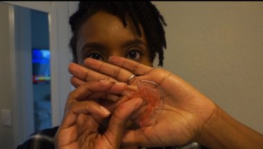 Hawley Retainer | Temporary Crown | Life After Braces